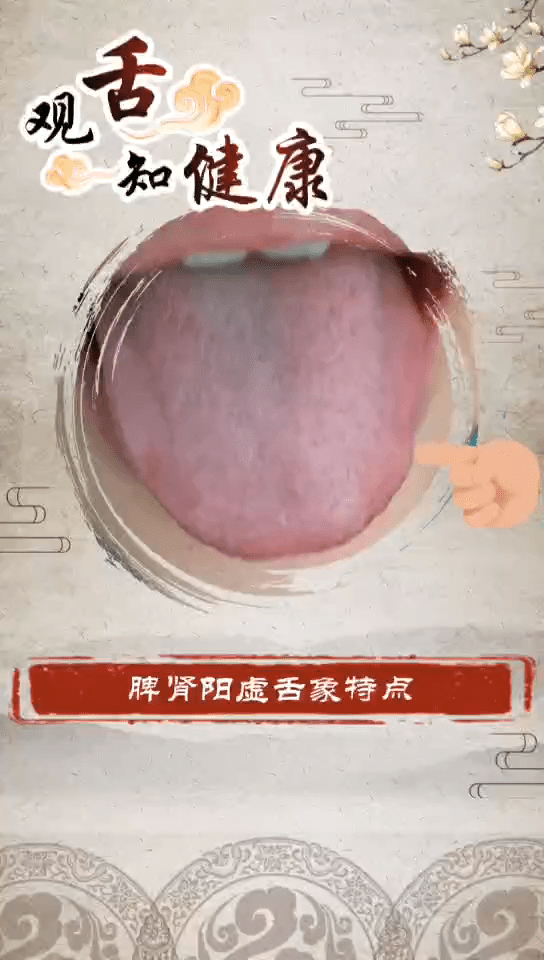 仙方谷养生馆:脾肾阳虚的舌象特点科普舌苔