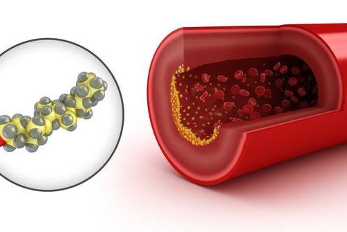 甘油三酯的"天敌"找到了,隔三差五吃点,血管或能一通到底
