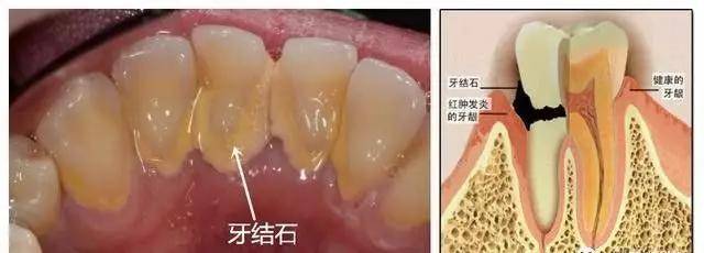 我们为您搜索到549条博客结果