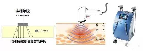 医美专区 | 干货!射频紧肤为什么能成为抗衰老的宠儿?