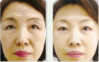 1e5c0197a4b24fa385e59be3ab368d44.png