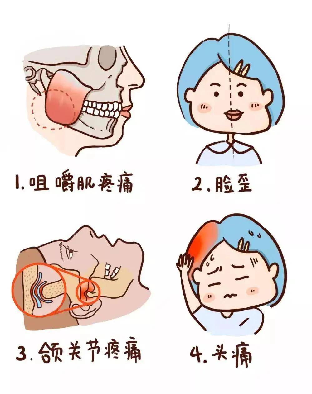 下巴关节虽小,损伤事大,如果下巴关节出现异常响声,张口受限或