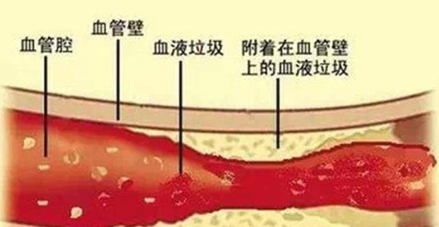 99a70360b7e24fa8b8088ae4ad4fd522.jpeg