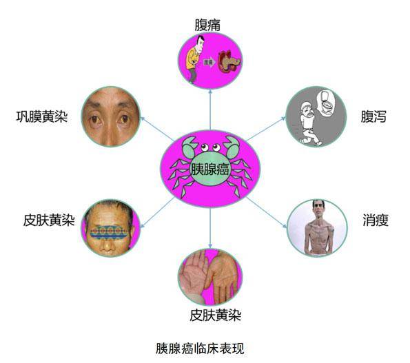 42cb472759234db0953cd3565bfb28a8.jpeg