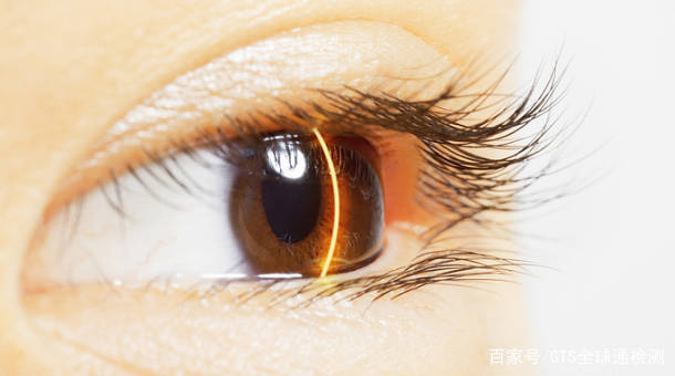 激光是不是很伤眼睛 cfcf1ceba7e54caa9272b71a77a9ecf6.jpeg