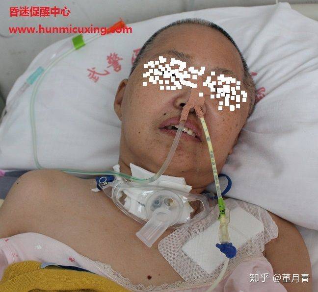 脑出血昏迷怎么办