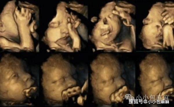 孩子|正在「谋杀」自己的孩子！有这个习惯的父母