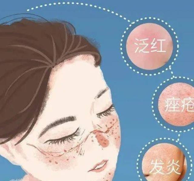 "口罩脸"自救指南来了!