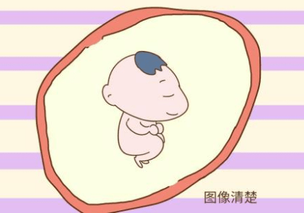 4acc85e72b544be5ae1e3915d5293c86.png