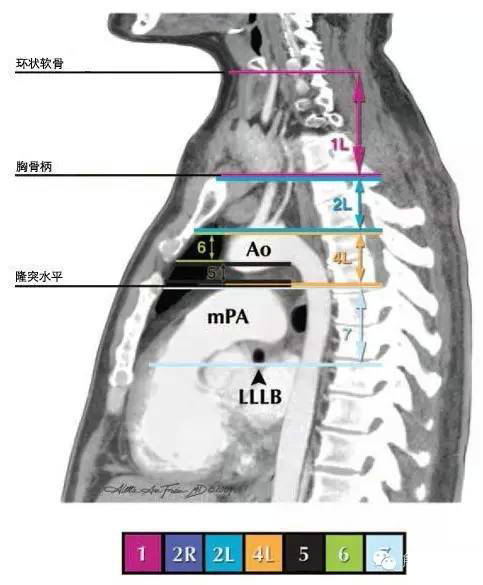 今日分享 — 纵隔淋巴结分区图谱