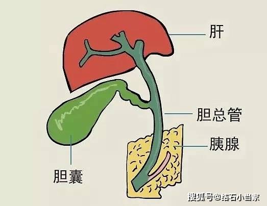 中医治疗胆结石选择哪些药材比较好记住这些