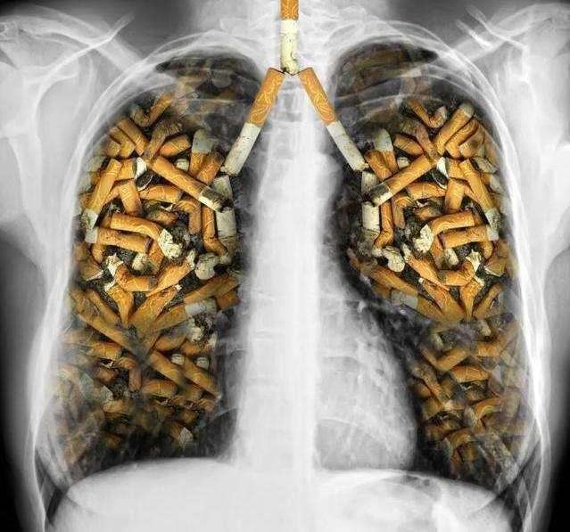 被动吸烟与环境吸烟也是肺癌的病因之一. 职业接触