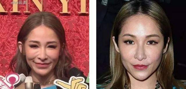 全脸填充王心凌变金星,整容失败怎么办?过来人:后悔也