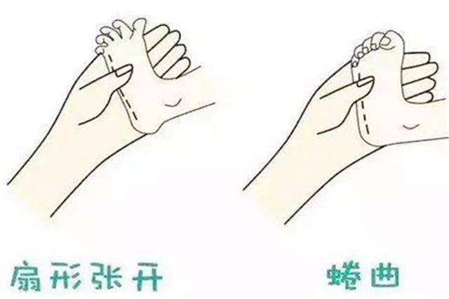 宝宝|6个月内基本会消失，若缺乏可能是“脑损伤”新生儿的8种反射