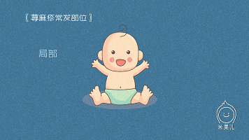 突发|多半是荨麻疹惹的祸!孩子身上突发红疙瘩