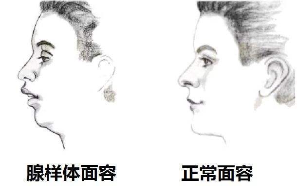 5ac9003e157a4d1b86ef26483ff5a1c1.jpeg
