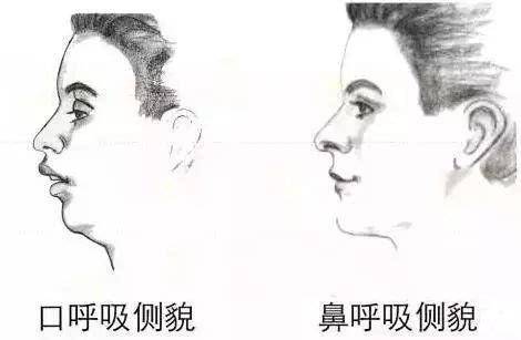 家长|会让宝宝颜值变丑，家长发现要及时改这些小习惯