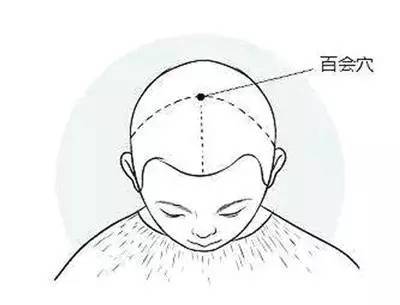 什么穴位可以缓解头痛 失眠 47d10a344ad4431dbfd4364ae0769607.jpeg