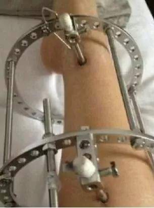 身高|这份宝宝长高的终极秘诀,请妈妈们收好12岁森碟变长腿少女