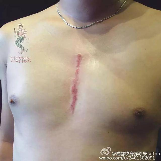 原创满月宝宝患重症，亲友劝放弃，爸爸：“再生一个就不是他了”