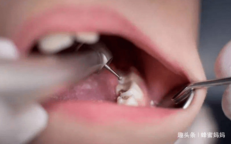 乳牙|重要时刻能“救命”？没这么简单宝宝“乳牙”掉了先别扔