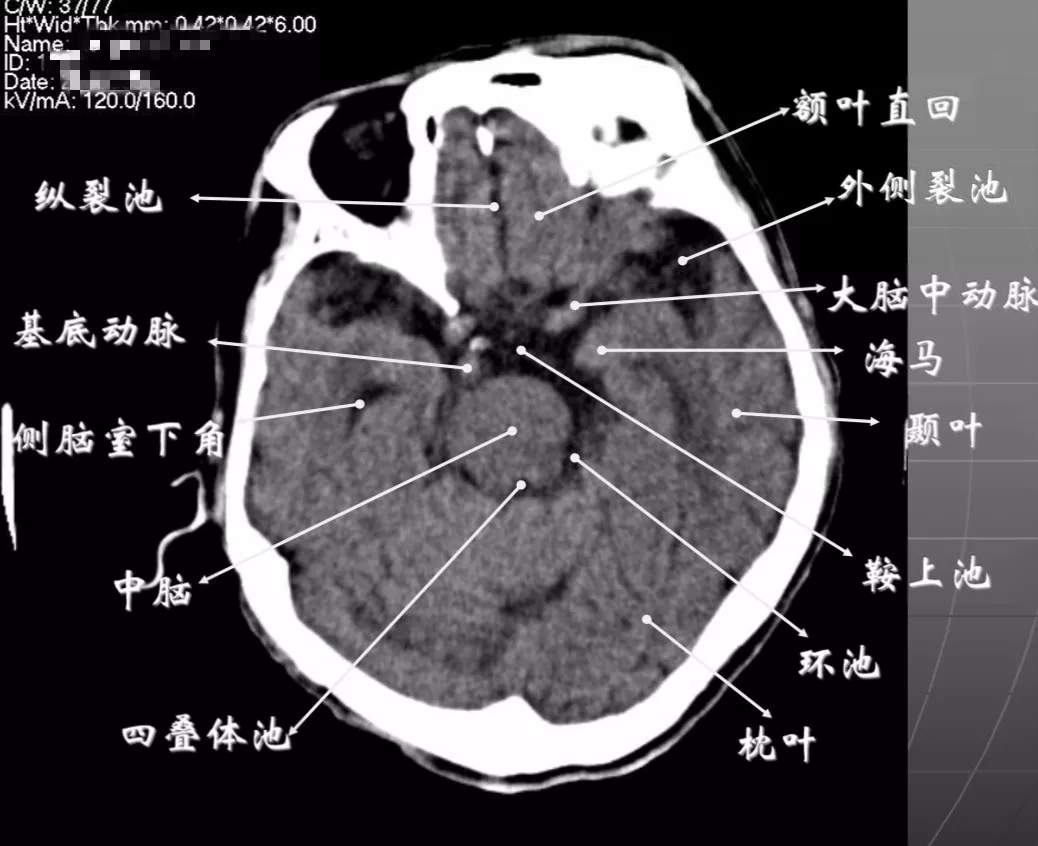 前六星人口_人口普查(3)