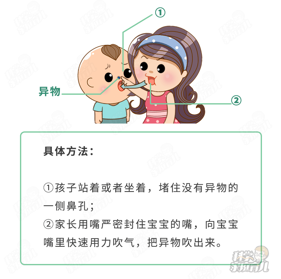 ③如果比较硬的异物完全堵塞鼻孔,可以试试"父母之吻"法.