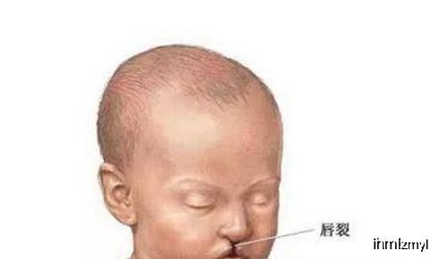原创当孕妈知道胎儿是“畸形”时，还坚持生下，这种行为是好还是坏？