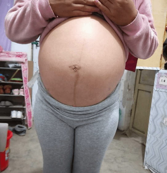 “孕晚期的肚子，却不如孕中期的大”孕期肚子足以说明什么？