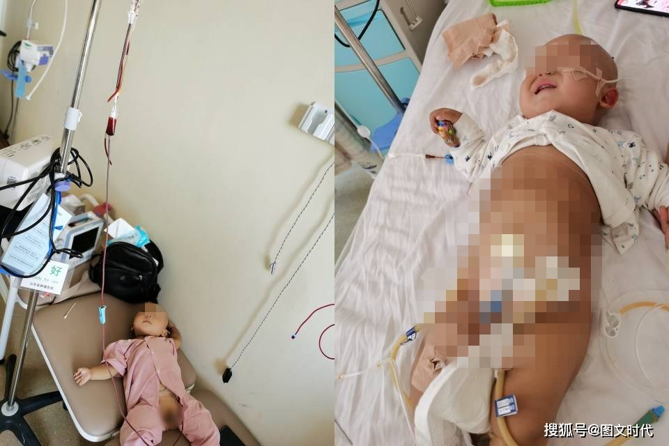 爸爸|爸爸发现了异常，送医后查出“儿童癌症之王”男婴肚子越来越大