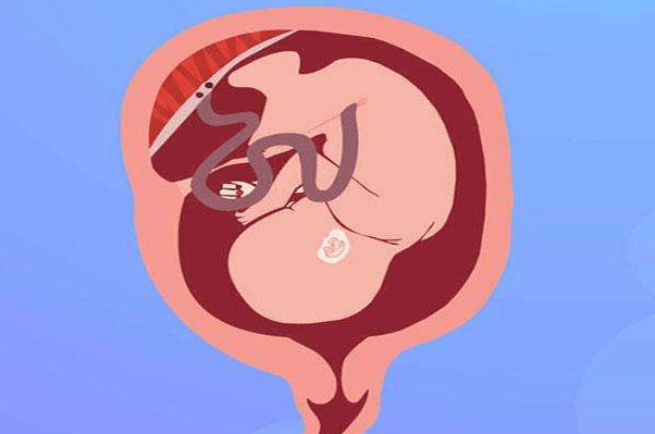 胎盘的位置是否正常密切关系到胎儿的正常发育.