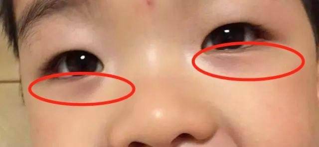 宝宝|孩子积食、不吃饭?这4个部位会说话