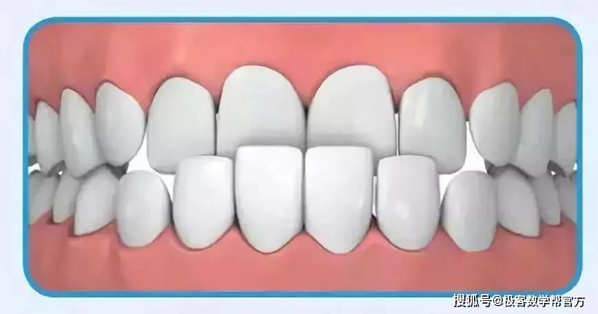 牙齿|家长请注意：孩子12岁前必须矫治的几种牙齿畸形