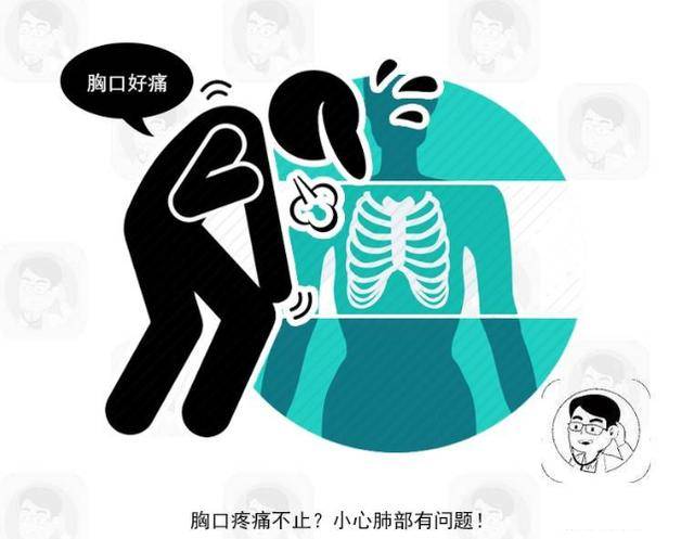 原创肺癌除了胸痛外若还有这4个表现警惕癌症已到中晚期