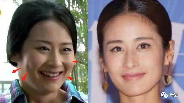 原创好歹也是娱乐圈第一代人造顶级美女,怎么也因为乱填充翻车了? 原创好歹也是娱乐圈第一代人造顶级美女,怎么也因为乱填充翻车了?