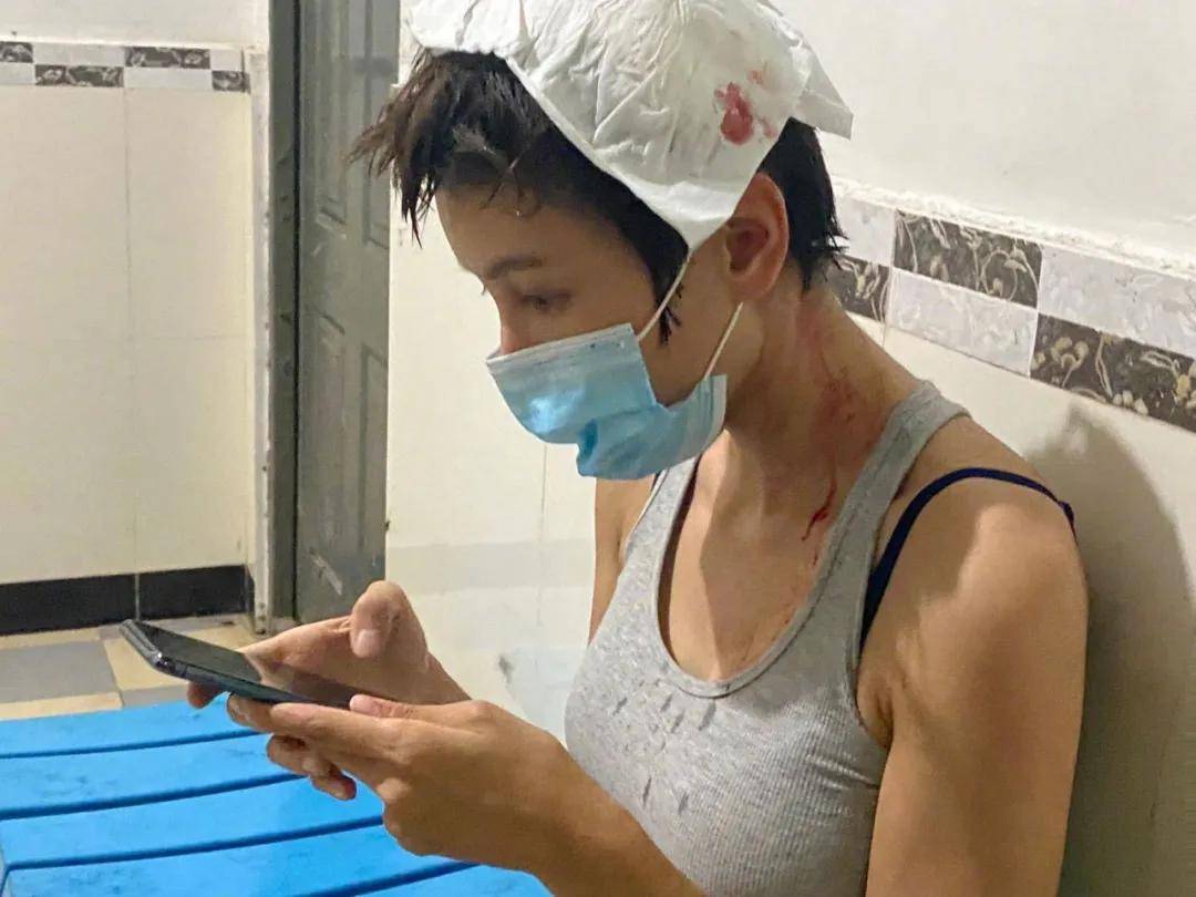 受伤|张蓝心拍戏头部受伤，头裹纱布满身血迹，为赶进度拒绝缝针