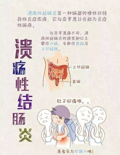 4,溃疡性结肠炎:出血混有黏液或呈脓血便,伴有腹痛,发热,便