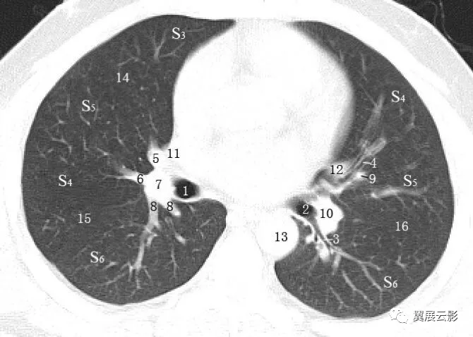 完美标注肺部横断面解剖肺门肺段及血管解剖