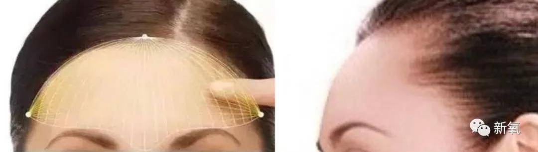 额头|宁静把郑希怡搞得脸都黑了，女明星暗斗场面这么刺激的吗？？
