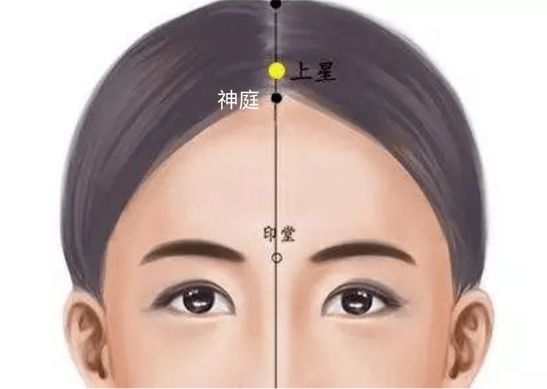 至速,由轻至重,反复推摩约1分钟,此时推摩局部产生热感,并向眉心集中