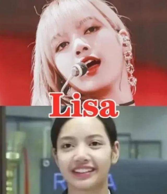 后移|鞠婧祎高发际线曝光,杨幂被质疑植发,她们二十多岁发际线堪忧