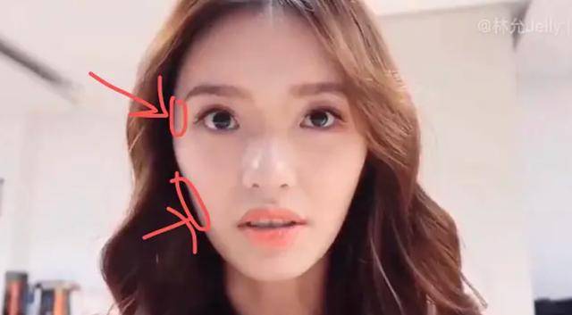 颧骨|王嘉尔变成牙套脸?颧骨外扩太阳穴也凹陷,太多明星因此颜值骤降