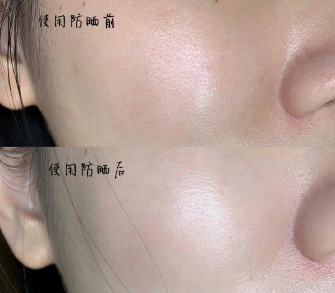 皮肤|一年四季防晒都要做足！但是别忘了在家也要擦上防晒霜