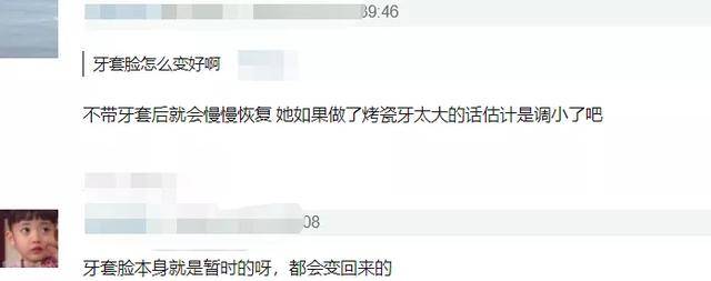 颧骨|王嘉尔变成牙套脸?颧骨外扩太阳穴也凹陷,太多明星因此颜值骤降