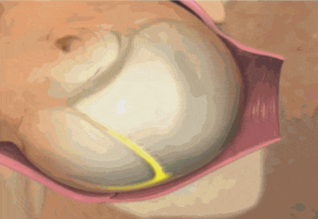 终于,伴随着响亮的哭声,宝宝终于呱呱坠地!