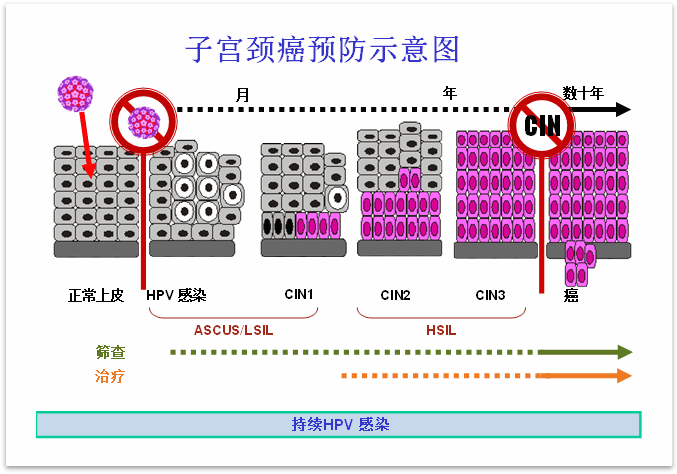 乔友林教授 hpv疫苗和筛查结合是最佳的宫颈癌预防方式