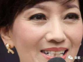 张脸|当年艳绝四方让张雨绮都甘心做配,可现在这张脸说崩就崩了...