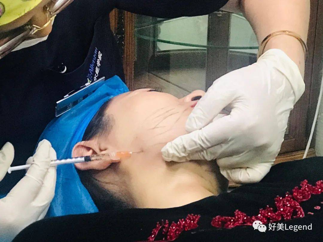 连喜艳|这回我可以大声的说：双下巴，再见！