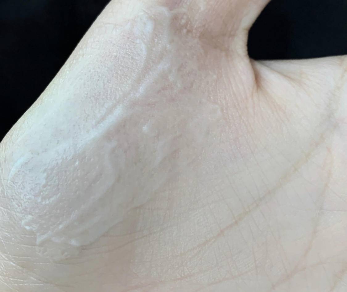 夏天|拒绝做天生“油”物，教你摆脱油腻带来的困扰吧