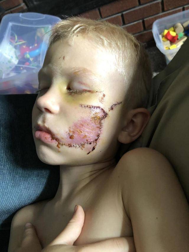 腰带|美国6岁男孩收到WBC荣誉金腰带，为救妹妹勇斗恶犬，泰森给他点赞